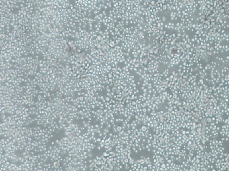 SU-DHL-2 Cell Complete Medium-searchlist-1