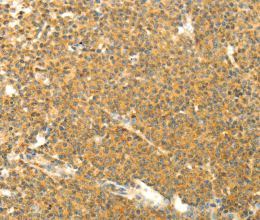AARS2 Polyclonal Antibody - 2