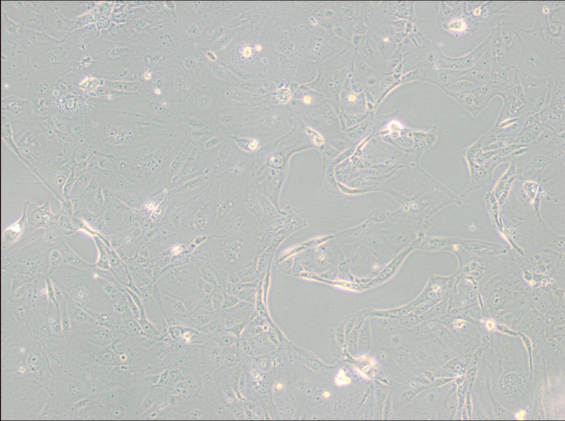 MKN-7 [MKN7; MKN 7] Cell Complete Medium - 1