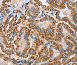 MSMB Polyclonal Antibody - 2
