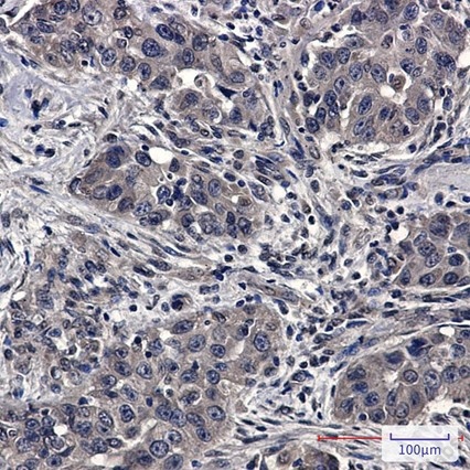 Recombinant SFT Monoclonal Antibody - 3