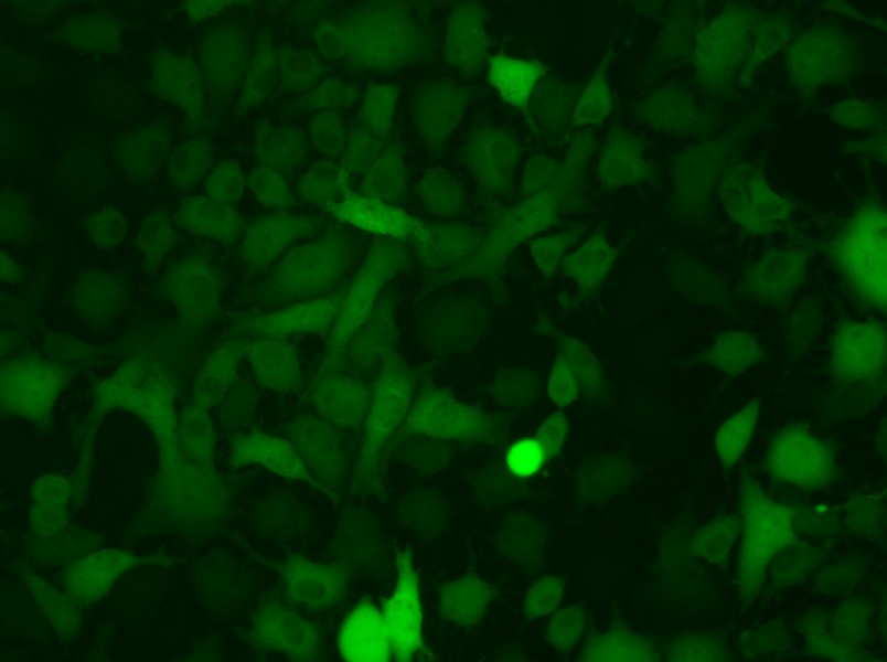 B16-F10-GFP Cell Complete Medium - small - 5