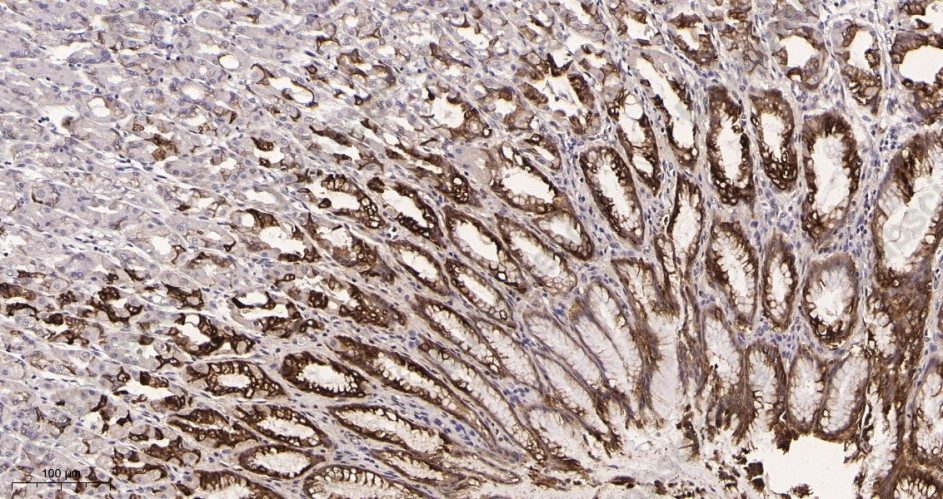 Recombinant Mucin 5AC Monoclonal Antibody - 2
