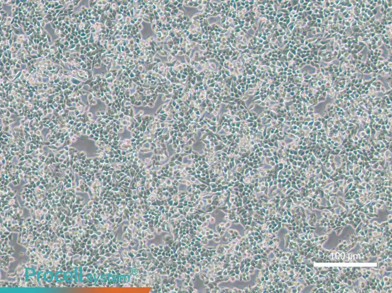 SW620-GFP - 1