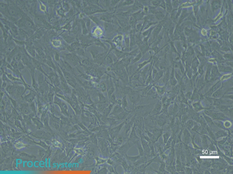 Rat Meningeal Fibroblast Complete Medium - 5