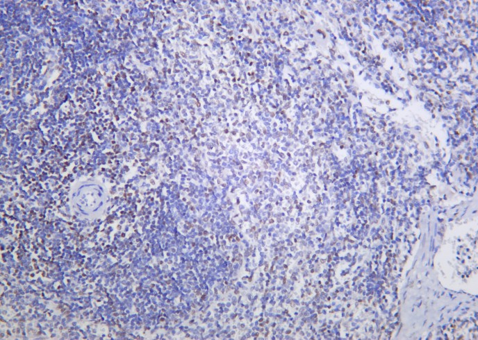 Recombinant Dnmt3a Monoclonal Antibody - small - 2