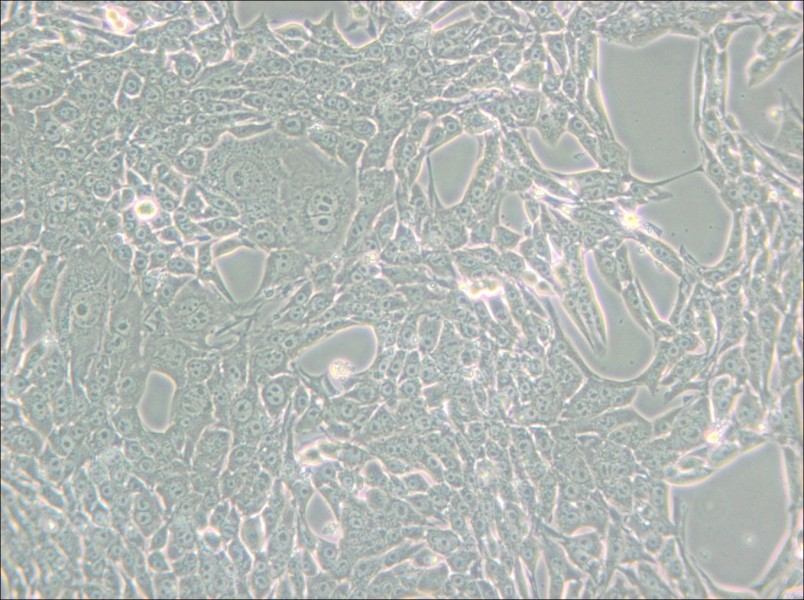 Renca [RenCa] Cell Complete Medium - 4