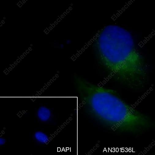 Recombinant GOSR1/GS28 Monoclonal Antibody - 4