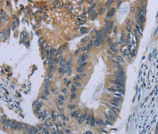 CEBPD Polyclonal Antibody - 3