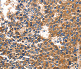 IRF1 Polyclonal Antibody - 2