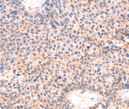 AMPD1 Polyclonal Antibody - 2