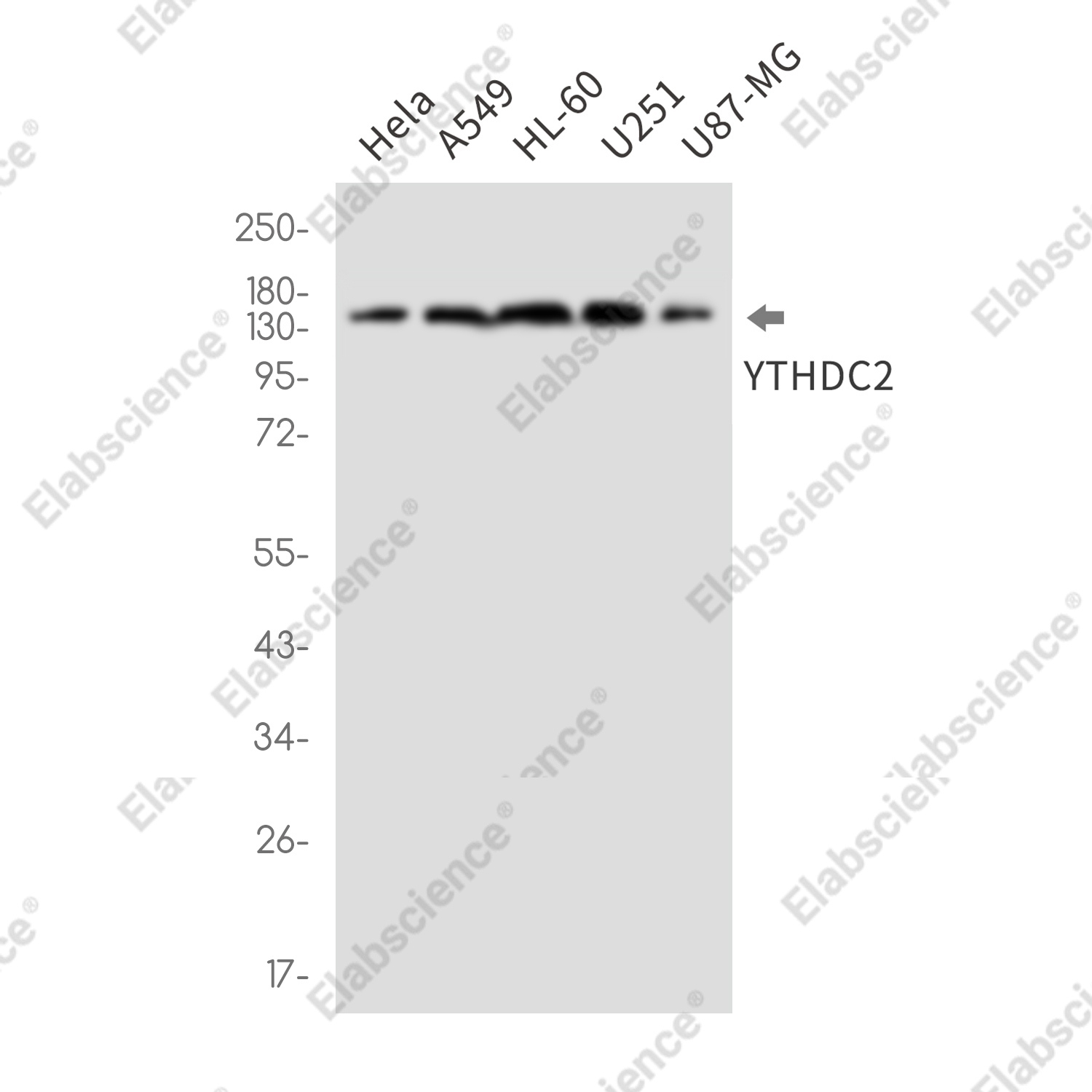 Recombinant YTHDC2 Monoclonal Antibody - 1
