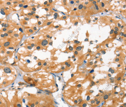 SMAD3 Polyclonal Antibody - 3