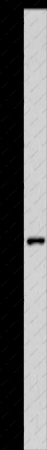 MC2R Polyclonal Antibody - 1