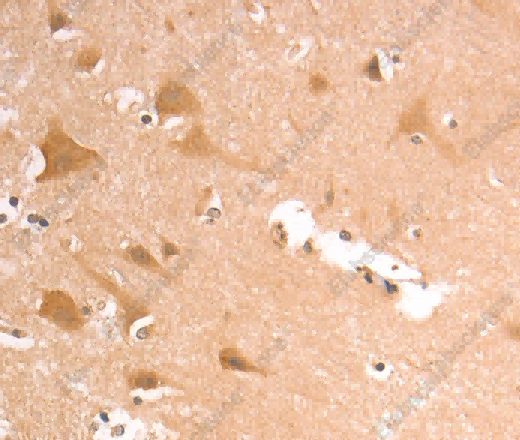 AASDHPPT Polyclonal Antibody - 3