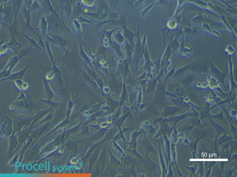 Mouse Hepatic Stellate (Primary cell immortalization) Cell Complete Medium - small - 4