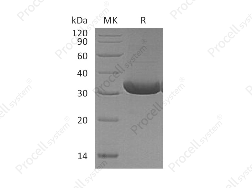 RANKL/TRANCE/TNFSF11 (N-6His), Mouse, Recombinant