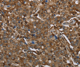 ARHGDIA Polyclonal Antibody - 2