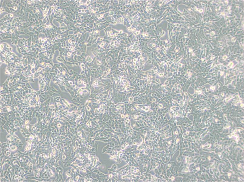 NCI-H295R Cell Complete Medium-searchlist-1