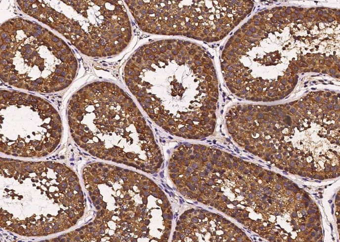 Recombinant HSP70/HSPA1A Monoclonal Antibody - small - 3