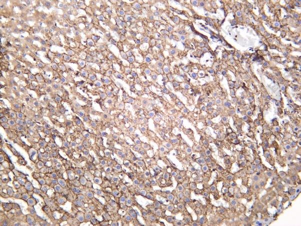 Recombinant Annexin VI Monoclonal Antibody - 3