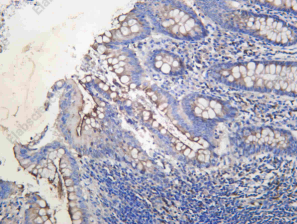 Recombinant CEACAM1 Monoclonal Antibody - 1
