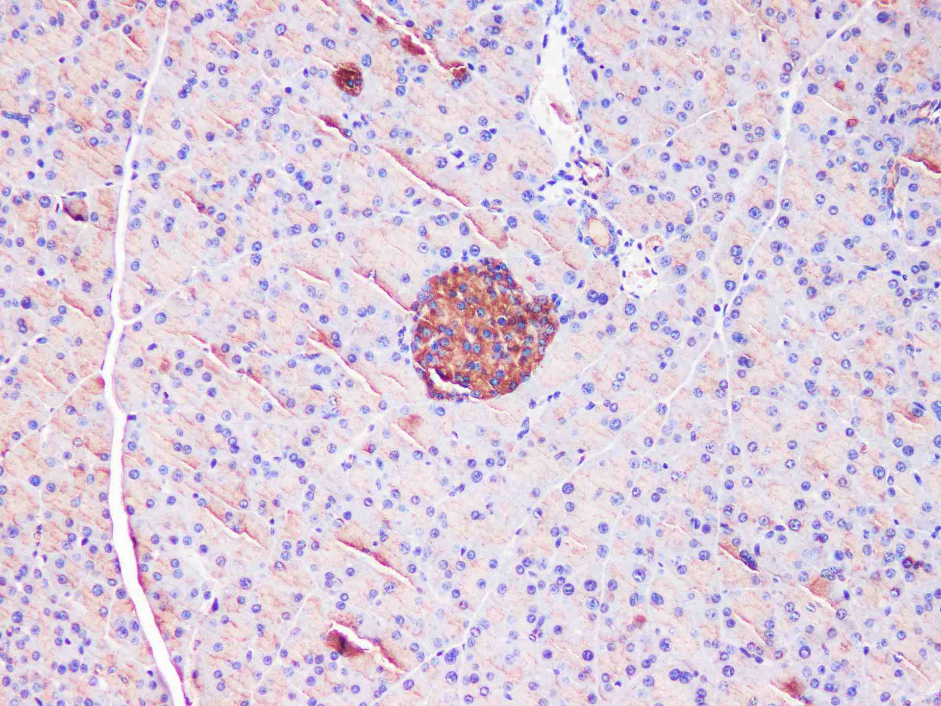 EEF2 Polyclonal Antibody - small - 4