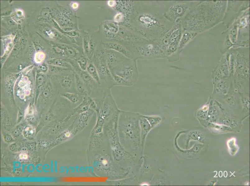 MKN-7 [MKN7; MKN 7] Cell Complete Medium - small - 4