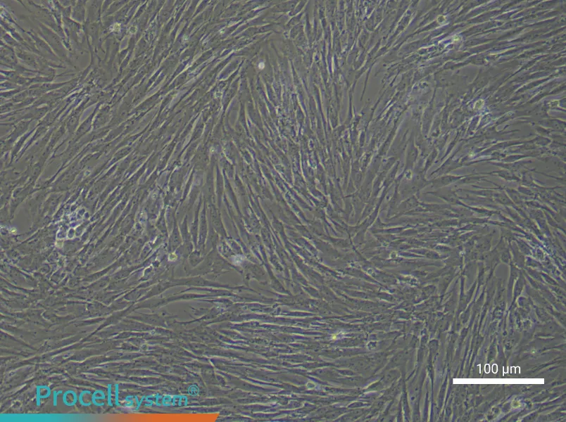 Human Lung Fibroblast Complete Medium - 1