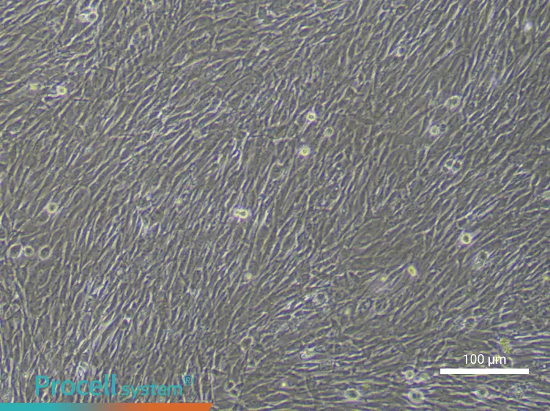 Human Adipose-derived Mesenchymal Stem (Primary cell immortalization) Cell Complete Medium - 1