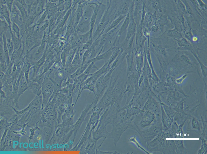 Mouse Cerebral Artery Smooth Muscle Cell Complete Medium - 4