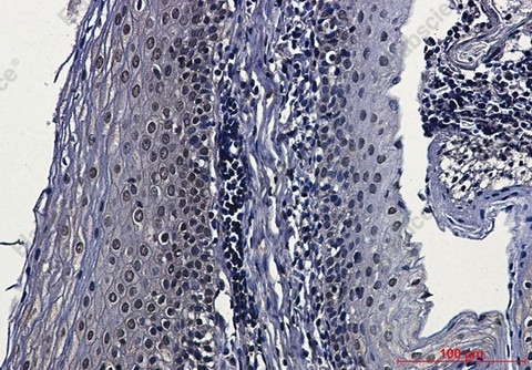 Recombinant Casein Kinase 2 beta Monoclonal Antibody - 5