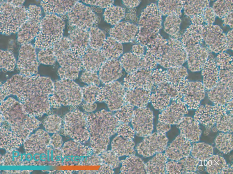 HuT 102 Cell Complete MediumHuT 102 Cell Complete Medium - 2