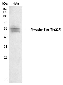 Recombinant Phospho-Tau (Thr217) Monoclonal Antibody - small - 2