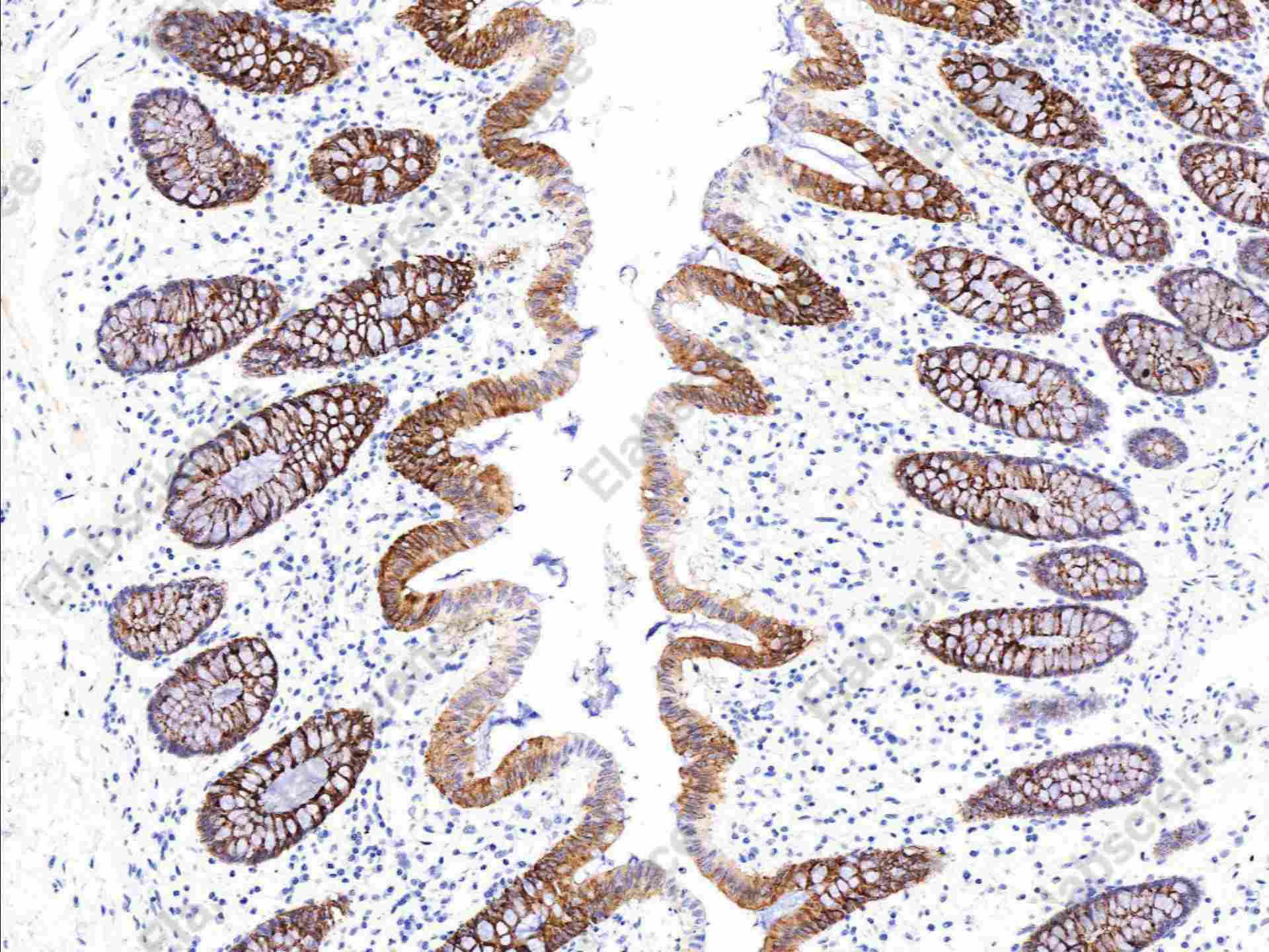 Recombinant PIGR Monoclonal Antibody - 1