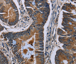 SLC1A6 Polyclonal Antibody - 3