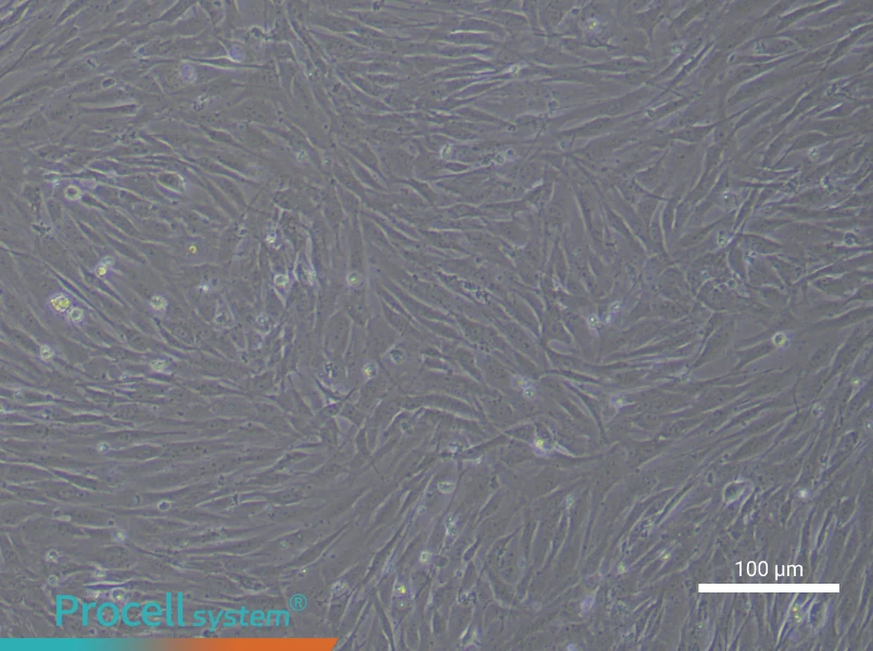 Human Aortic Smooth Muscle (Primary cell immortalization) Cell Complete MediumHuman Aortic Smooth Muscle (Primary cell immortalization) Cell Complete Medium - 3