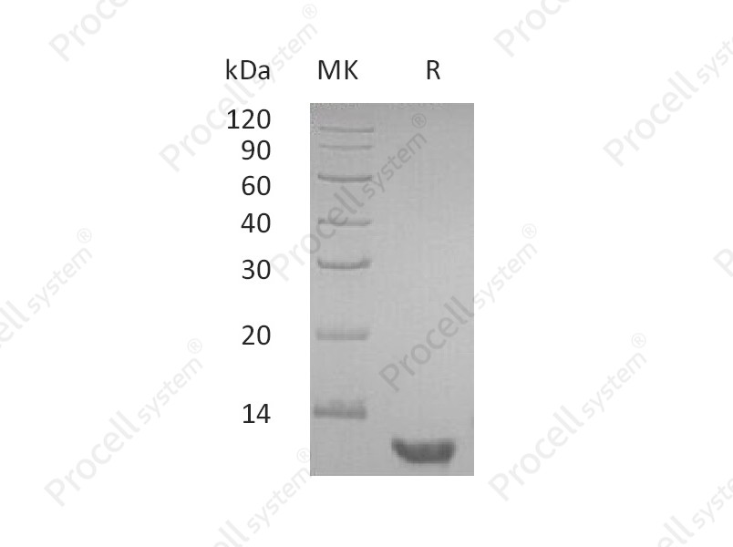 EGF/Urogastrone/URG, Human, Recombinant