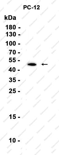 Recombinant beta III Tubulin Monoclonal Antibody - 1