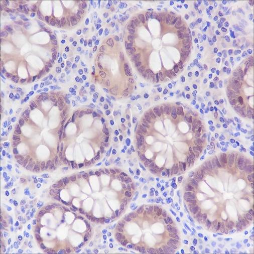 Recombinant SETBP1 Monoclonal Antibody - 2