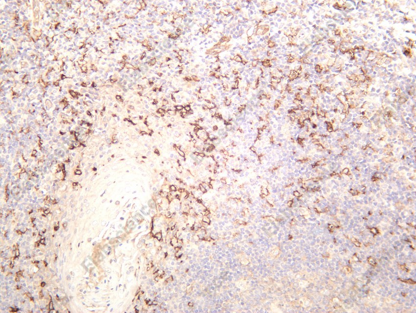 Recombinant CD14 Monoclonal Antibody - 3