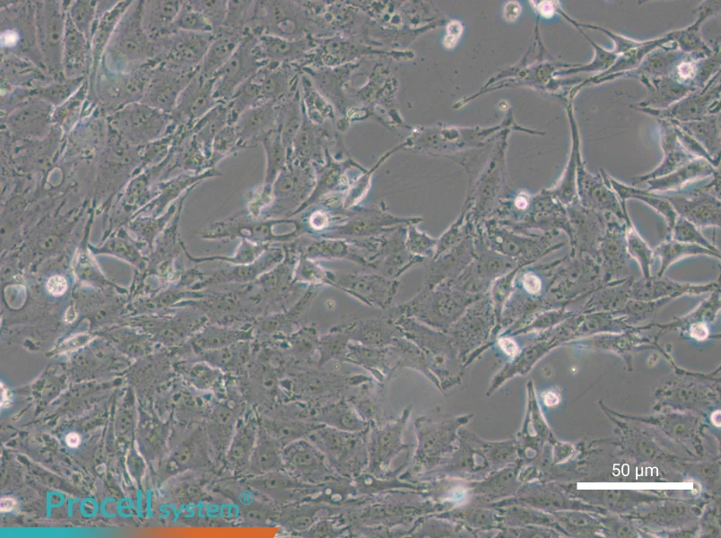 IBRS-2 [IB-RS-2] - 5