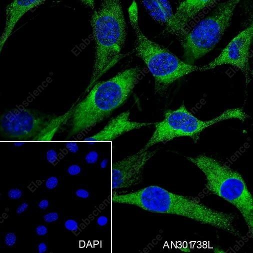 Recombinant CRMP2 Monoclonal Antibody - 5