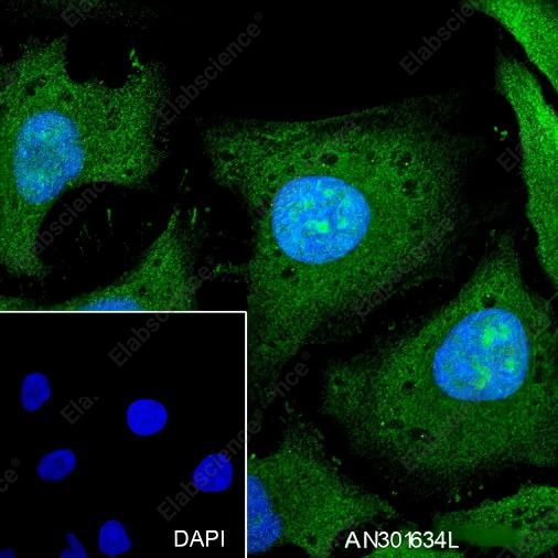 Recombinant PPP1CB Monoclonal Antibody - 3