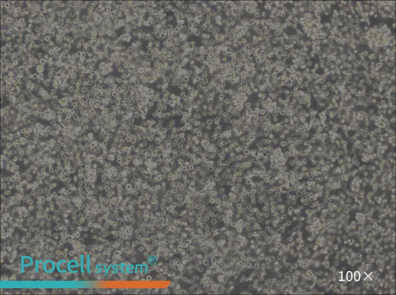 MEC-1 Cell Complete MediumMEC-1 Cell Complete Medium - 3