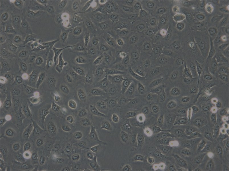 OVCA429 Cell Complete Medium - small - 5