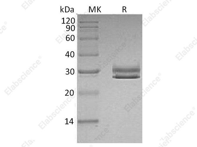 Recombinant Human JAM-A/F11R Protein (His Tag) - 1