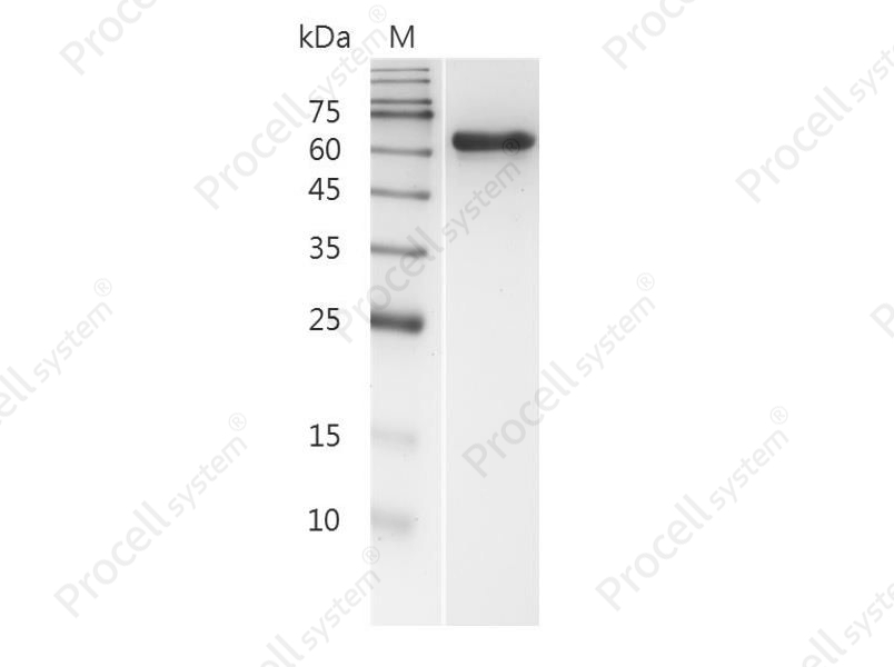 MMP2/Gelatinase A/TBE-1/MONA, Human, Recombinant