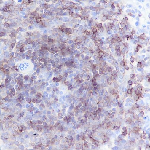 Recombinant CD79b Monoclonal Antibody - 2
