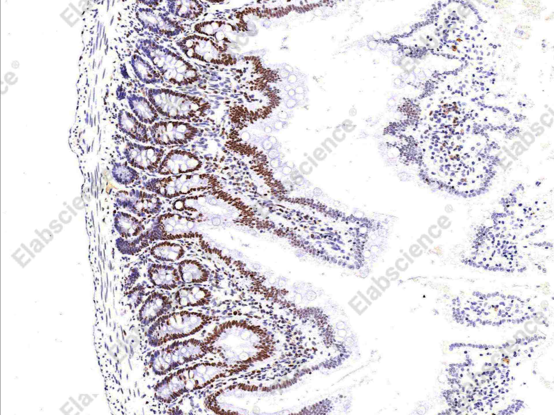 Recombinant MSH6/GTBP Monoclonal Antibody - 3